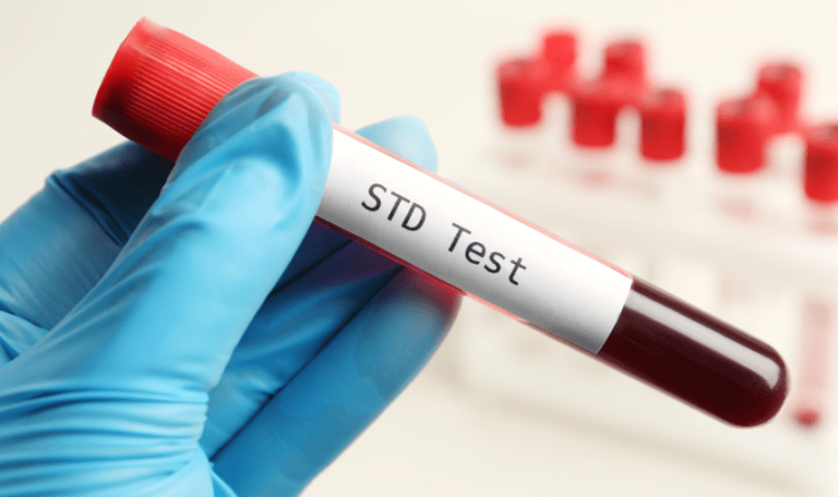 Where Can I Get a Confidential STD Blood Test?