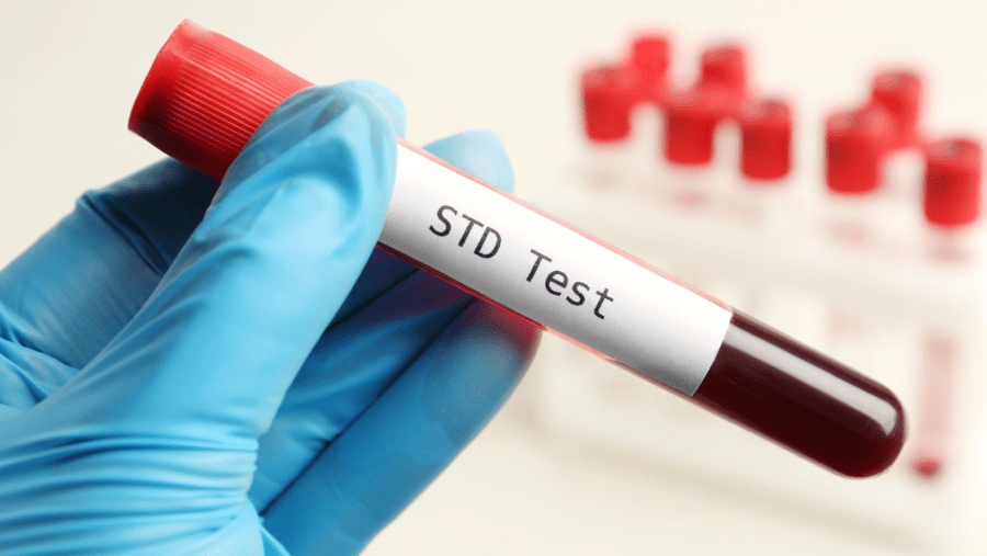 Home 22 std blood test